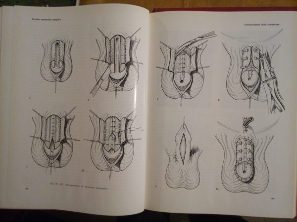 Trattato-Atlante di Chirurgia Plastica e Ricostruttiva - H. Gelbke - immagine 7