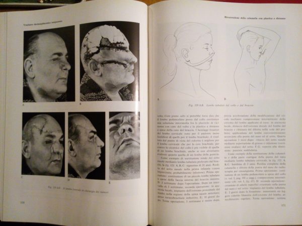 Trattato-Atlante di Chirurgia Plastica e Ricostruttiva - H. Gelbke - immagine 9