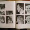 Trattato-Atlante di Chirurgia Plastica e Ricostruttiva - H. Gelbke - immagine 8