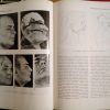 Trattato-Atlante di Chirurgia Plastica e Ricostruttiva - H. Gelbke - immagine 9